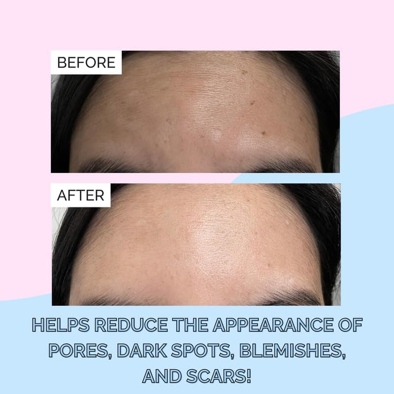 Korean Snail Mucin Serum - 97% Snail Secretion Filtrate for Deep Hydration & Glass Skin - Lightweight, Fast-Absorbing, Cruelty-Free, 100 Ml